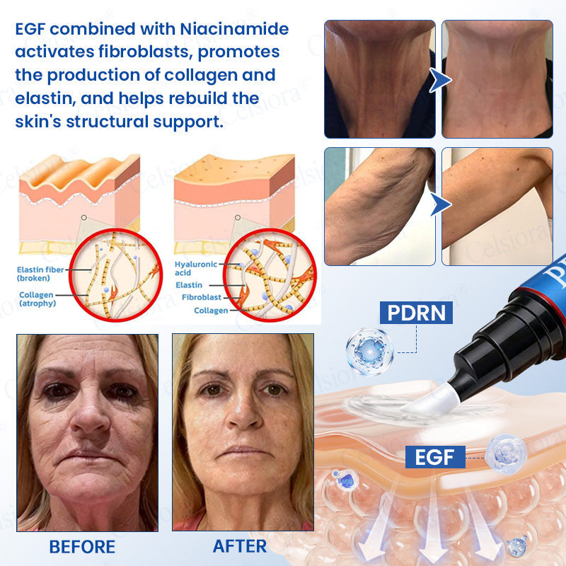 🥈📌 NAGY-BRITANNIAI SIKERTERMÉK – Celsiora® PDRN Ránctalanító Shot – Feszesítő és Lifting Krém