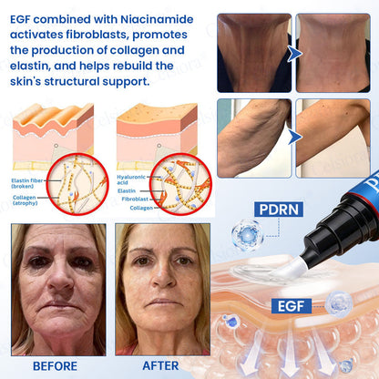 🥈📌 NAGY-BRITANNIAI SIKERTERMÉK – Celsiora® PDRN Ránctalanító Shot – Feszesítő és Lifting Krém
