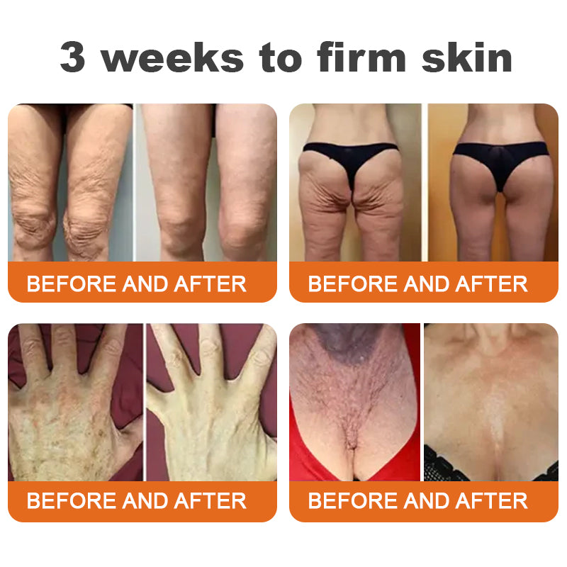 🐝Az USA-ban készült és onnan szállítva✨Flysmus™ Botox Méhméreg Feszesítő Szérum Stift🔥UTOLSÓ NAP – 70% KEDVEZMÉNY