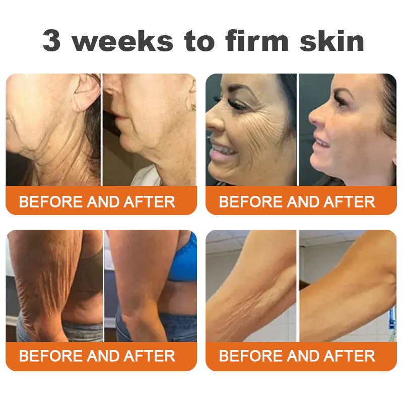 🐝Az USA-ban készült és onnan szállítva✨Flysmus™ Botox Méhméreg Feszesítő Szérum Stift🔥UTOLSÓ NAP – 70% KEDVEZMÉNY
