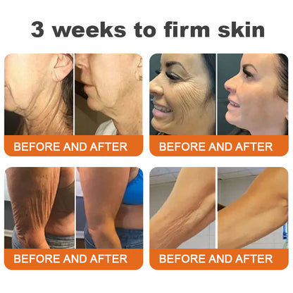 🐝Az USA-ban készült és onnan szállítva✨Flysmus™ Botox Méhméreg Feszesítő Szérum Stift🔥UTOLSÓ NAP – 70% KEDVEZMÉNY