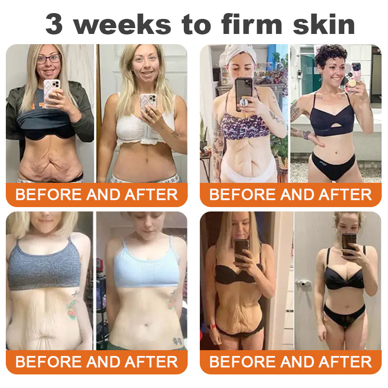 🐝Az USA-ban készült és onnan szállítva✨Flysmus™ Botox Méhméreg Feszesítő Szérum Stift🔥UTOLSÓ NAP – 70% KEDVEZMÉNY