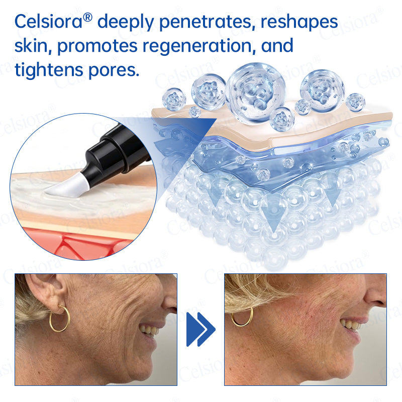 🥈📌 NAGY-BRITANNIAI SIKERTERMÉK – Celsiora® PDRN Ránctalanító Shot – Feszesítő és Lifting Krém