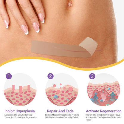 A bőrbizalom itt kezdődik ✅ Bostore® hialuronsavas nano mikrotűs regeneráló tapasz ✴️ Különféle hegek, striák, foltok, keloidok, keratózis, akne, égési sérülések, szemölcsök, bőrcímkék és visszerek kezelésére.