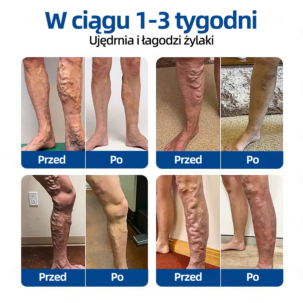 ✅ 👩‍⚕️👩‍⚕️ Healrize® VeinTarget mikro-tűs tapasz ⚡ Azonnali enyhülés, hosszan tartó eredmények