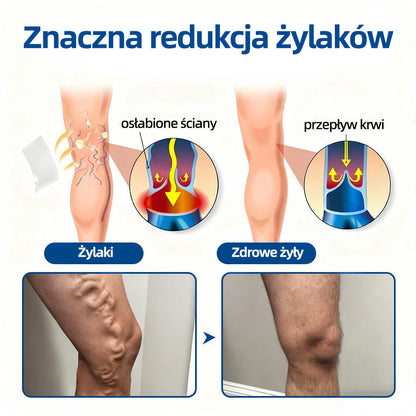 ✅ 👩‍⚕️👩‍⚕️ Healrize® VeinTarget mikro-tűs tapasz ⚡ Azonnali enyhülés, hosszan tartó eredmények